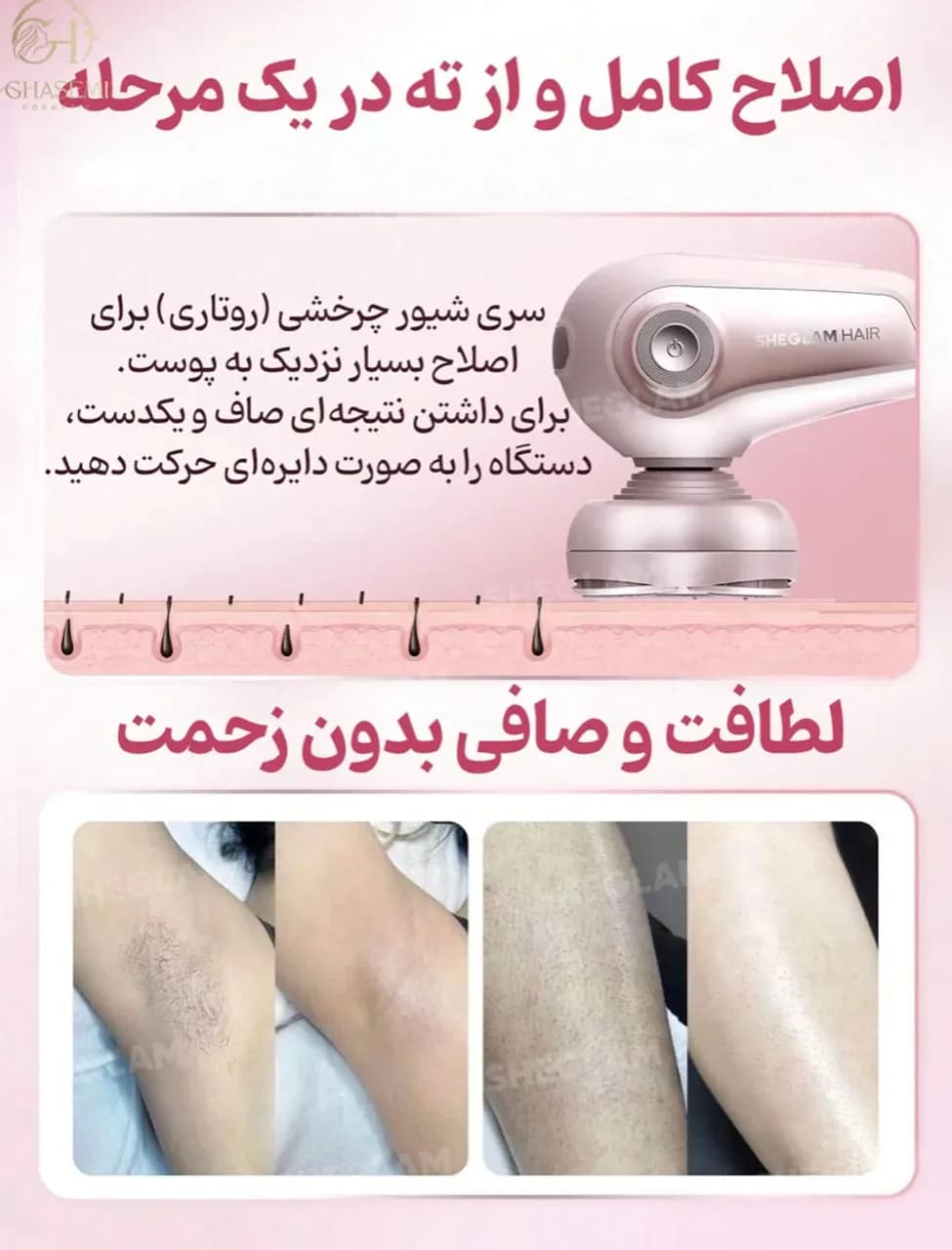 ماشین اصلاح ۵ سر Smooth Moves فول بادی — تصویر ۸