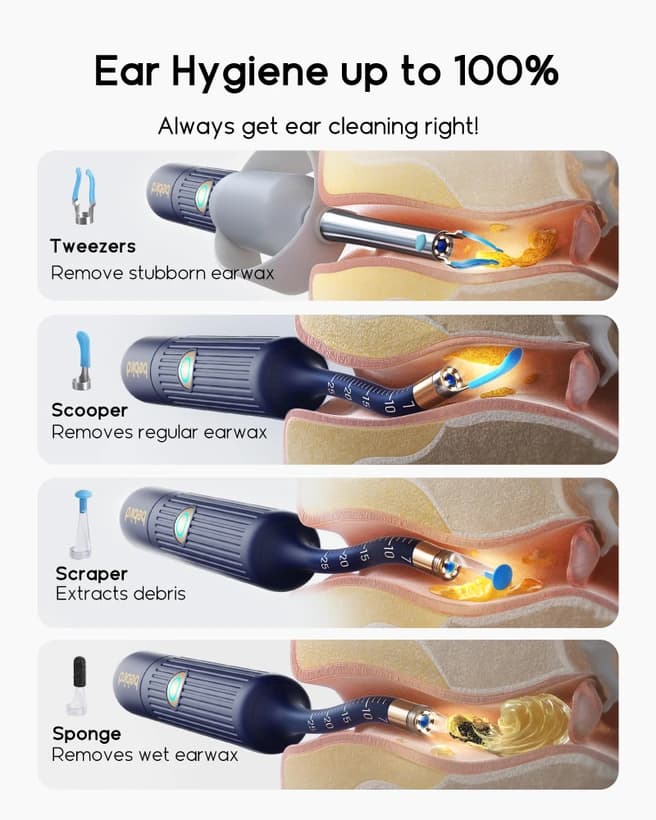 گوش پاک کن هوشمند دوربین دار Bebird EarSight Plus135R — تصویر ۳