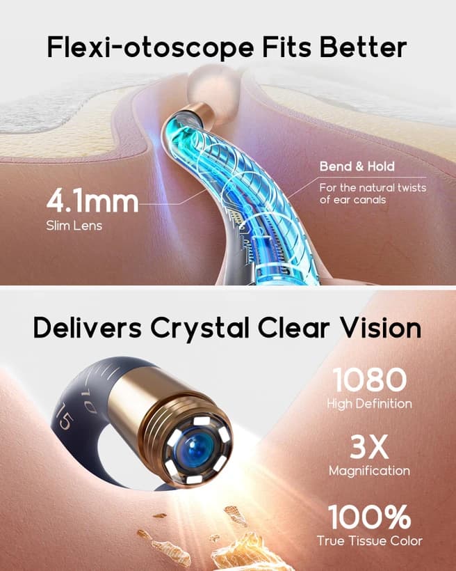 گوش پاک کن هوشمند دوربین دار Bebird EarSight Plus135R — تصویر ۴