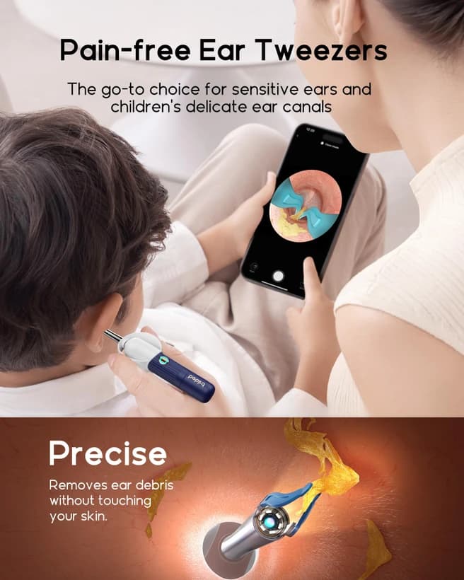 گوش پاک کن هوشمند دوربین دار Bebird EarSight Plus135R — تصویر ۵