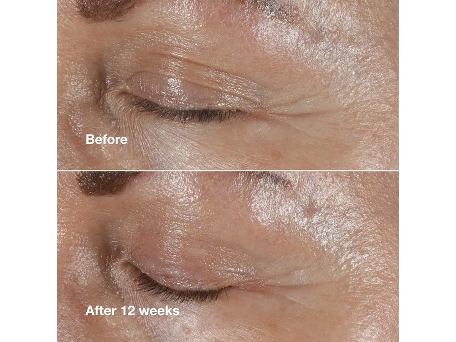 دور چشم ضد چروک و جوانساز کلینیک Clinique مدل Smart Clinical Repair حجم 15میل — تصویر ۱۱