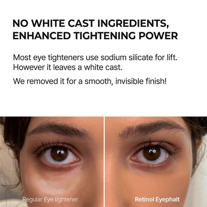 دور چشم رتینول دکتر ملاکسین Dr.Melaxin مدل Eyephalt Eyebag از بین برنده ی کیسه زیر چشمی, تیرگی و پف وزن 10 گرم — تصویر ۶