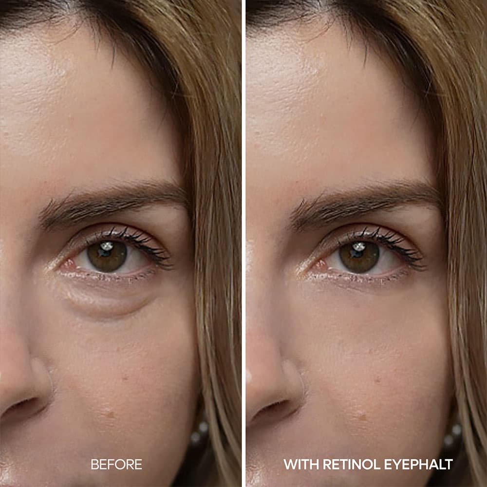 دور چشم رتینول دکتر ملاکسین Dr.Melaxin مدل Eyephalt Eyebag از بین برنده ی کیسه زیر چشمی, تیرگی و پف وزن 10 گرم — تصویر ۱۲