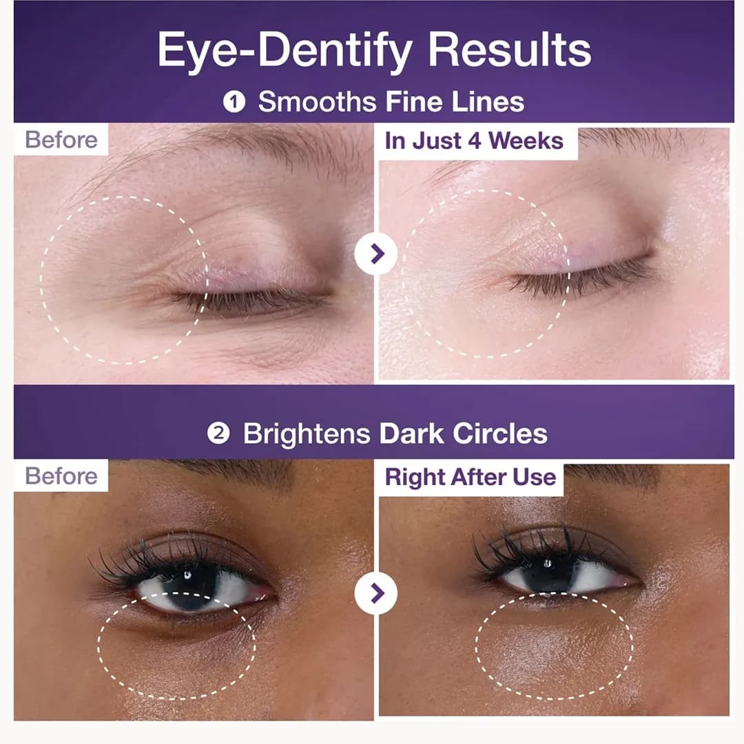 کرم دور چشم سری 9+ نامبوزین NAD+ Retinol حجم 10 میلی لیتری — تصویر ۵