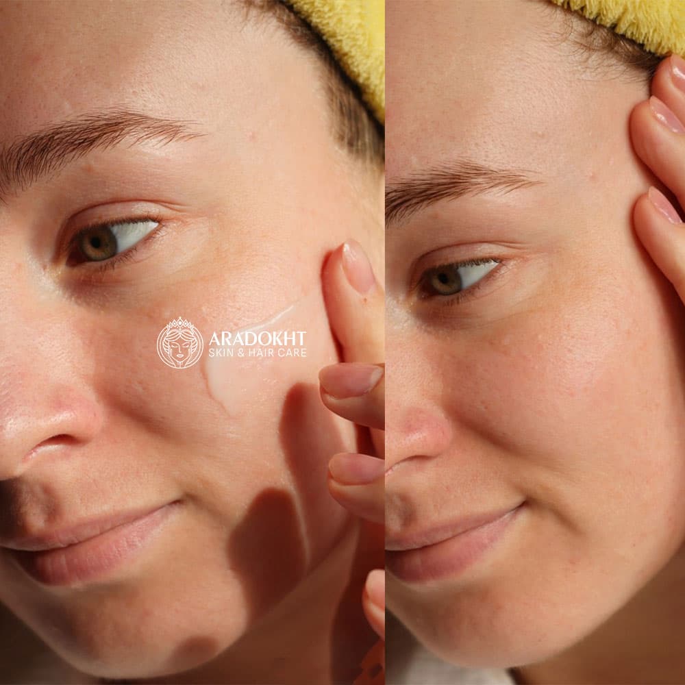 کرم مرطوب کننده افکلار پوست چرب لاروش پوزای La Roche-Posay Effaclar MAT Mattifying Face Moisturizer — تصویر ۵