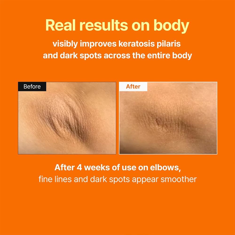 بوستر سرم رتینال مدی تراپی ضد چروک، روشن کننده و جوانساز پوست MEDITHERAPY Retinal Skin Booster Serum — تصویر ۹