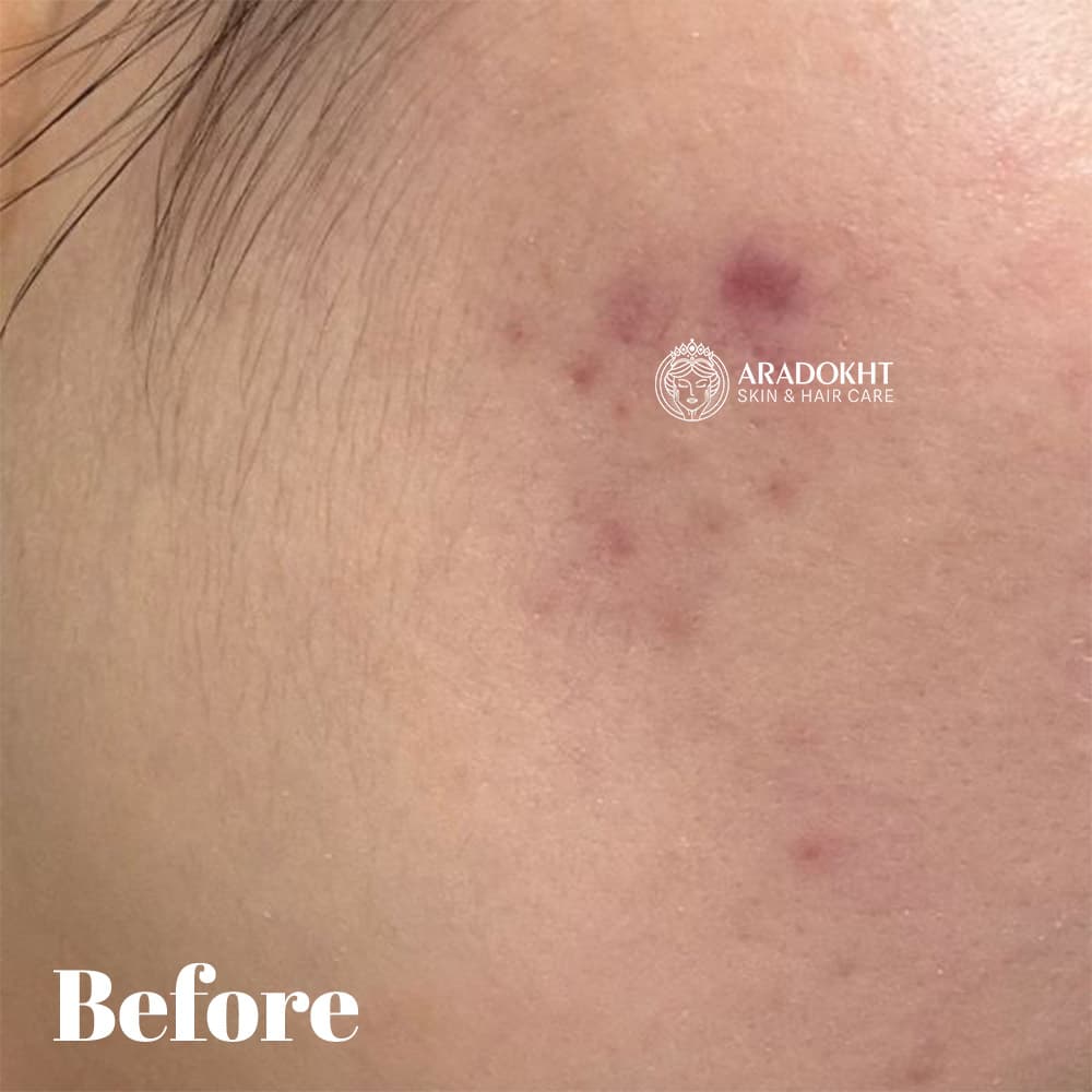بی بی کرم ضد آفتاب مات آنوا Anua Matt But Glow Cover Beige — تصویر ۸