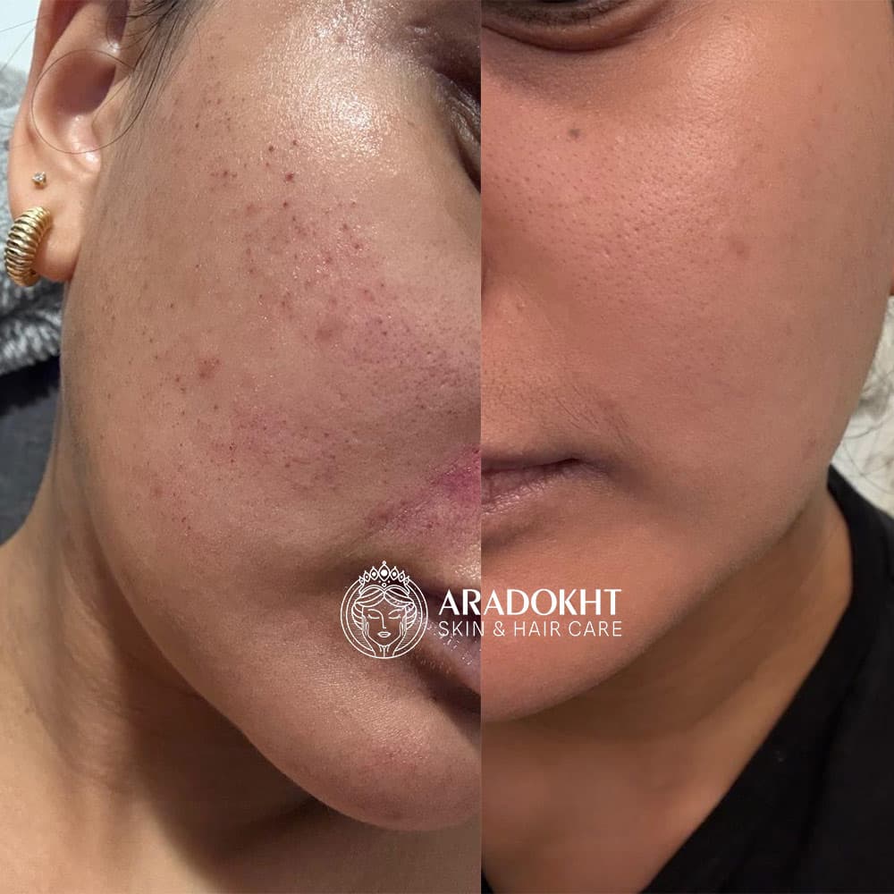 سرم کنترل منافذ PDRN بنفش اکوال بری EQQUALBERRY Purple PDRN Pore Minimizing Serum — تصویر ۵