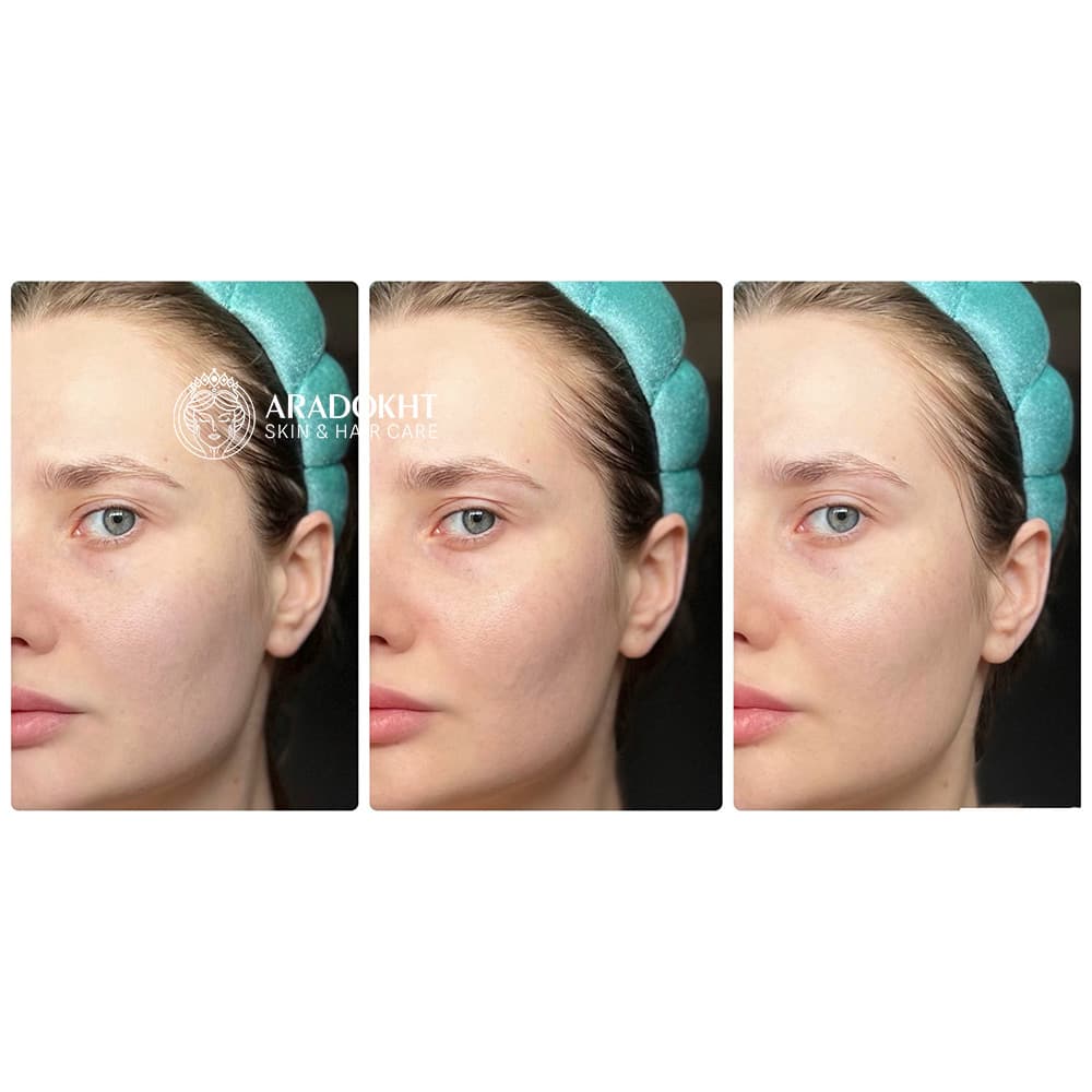 تونر کرمی بریر سلیمکس ترمیم و تقویت کننده سد دفاعی پوست Celimax Dual Barrier Creamy Toner — تصویر ۶