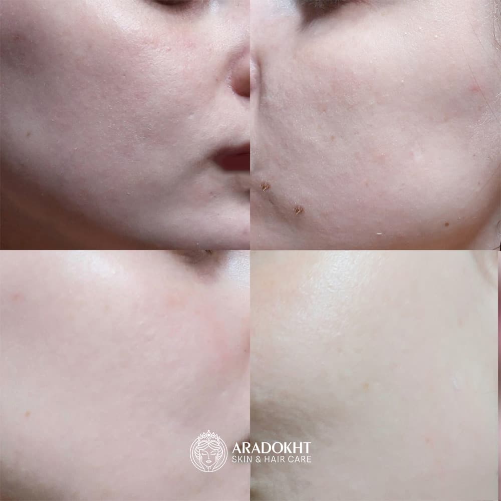 تونر کرمی بریر سلیمکس ترمیم و تقویت کننده سد دفاعی پوست Celimax Dual Barrier Creamy Toner — تصویر ۷