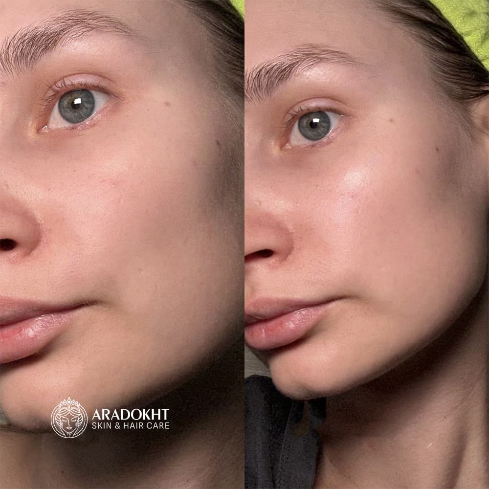 تونر کرمی بریر سلیمکس ترمیم و تقویت کننده سد دفاعی پوست Celimax Dual Barrier Creamy Toner — تصویر ۸