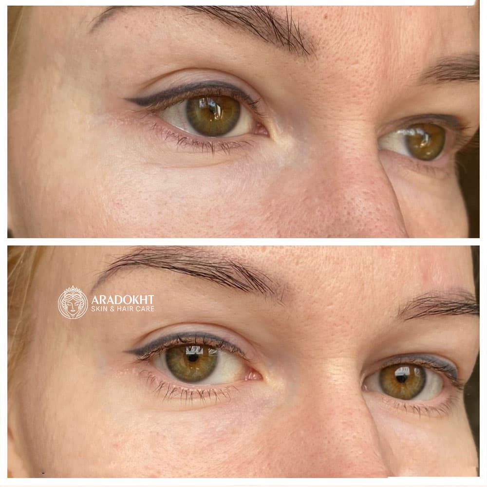 پک اختصاصی دور چشم ترانگزامیک اسید و گواشا مری اند می Mary &amp; May Glutathione Eye Cream Kit — تصویر ۷