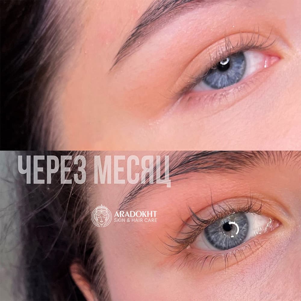 سرم تقویت مژه اتود Etude My Lash Serum — تصویر ۴