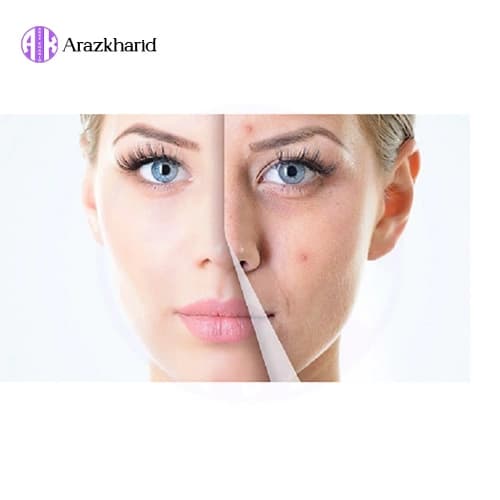 کرم اسنس ترمیم کننده موی پرفکت میزانسن Mise En Scene Perfect Cream Essence — تصویر ۱۱