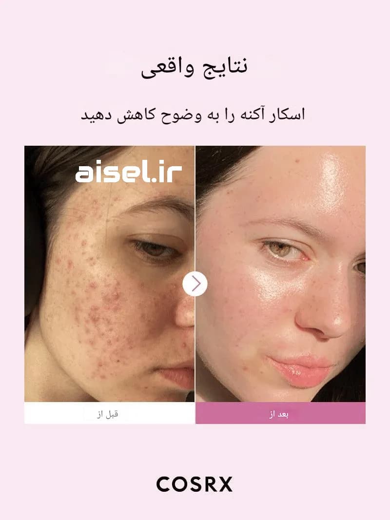 سرم نیاسینامید کوزارکس %15 حجم 20 میلی لیتر — تصویر ۳