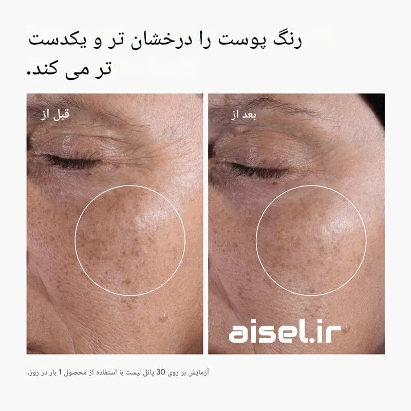 سرم نیاسینامید کوزارکس %15 حجم 20 میلی لیتر — تصویر ۱۲
