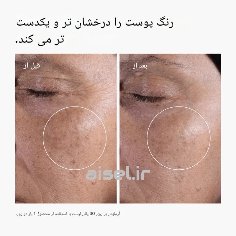 تونر گلیکولیک اسید اوردینری %7 لایه بردار و روشن کننده پوست حجم 240 میلی لیتر — تصویر ۵