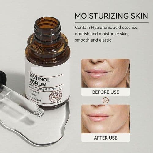 سرم اریو رتینول IREV RETINOL SERUM — تصویر ۴