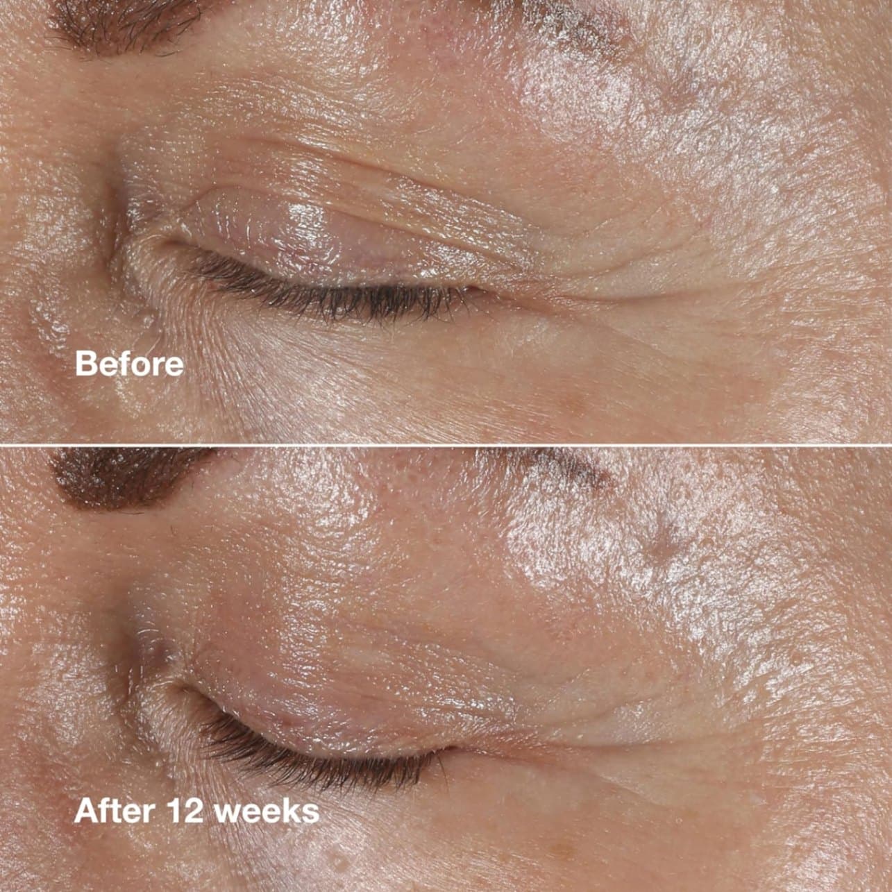 کرم دور چشم اسمارت کلینیک. Clinique smart clinical repair wrinkle correction eye cream 15ml — تصویر ۷