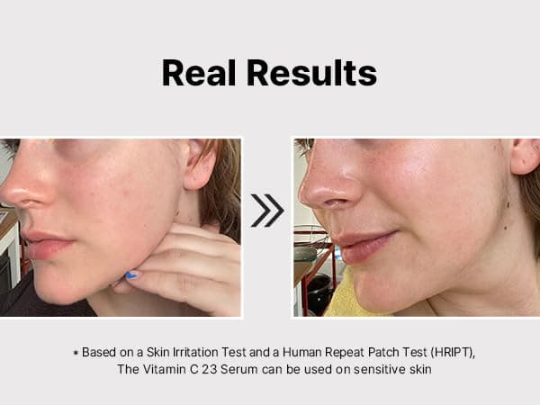 سرم ویتامین سی روشن کننده کوزارکس cosrx the vitamin C 23 serum 20g — تصویر ۷