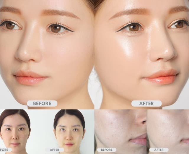 کرم آبرسان هیالورونیک اسید کوزارکس کوزارکس cosrx hyaluronic acid intensive cream — تصویر ۱۲