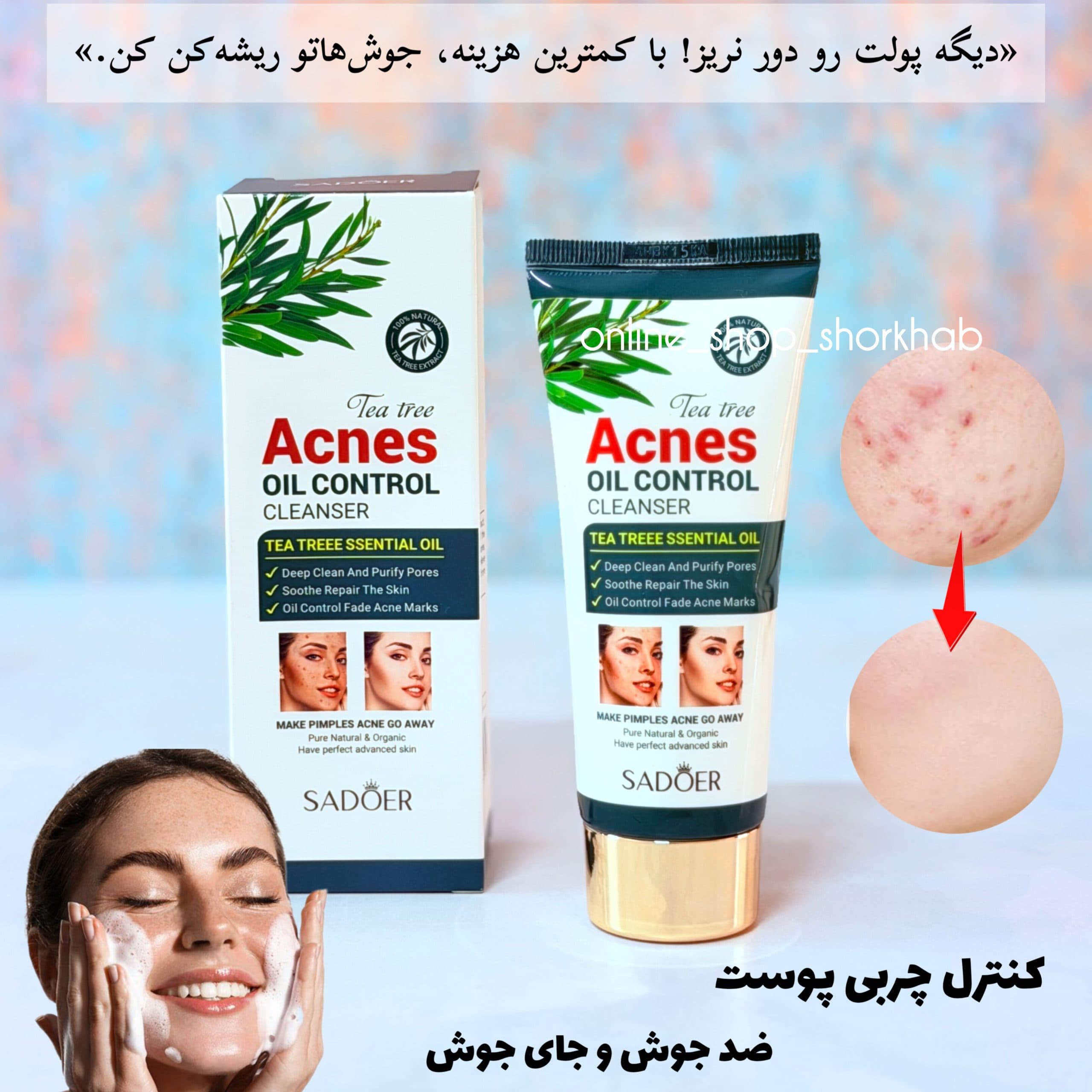 فوم شستشوی چای سبز ضد جوش — تصویر ۳