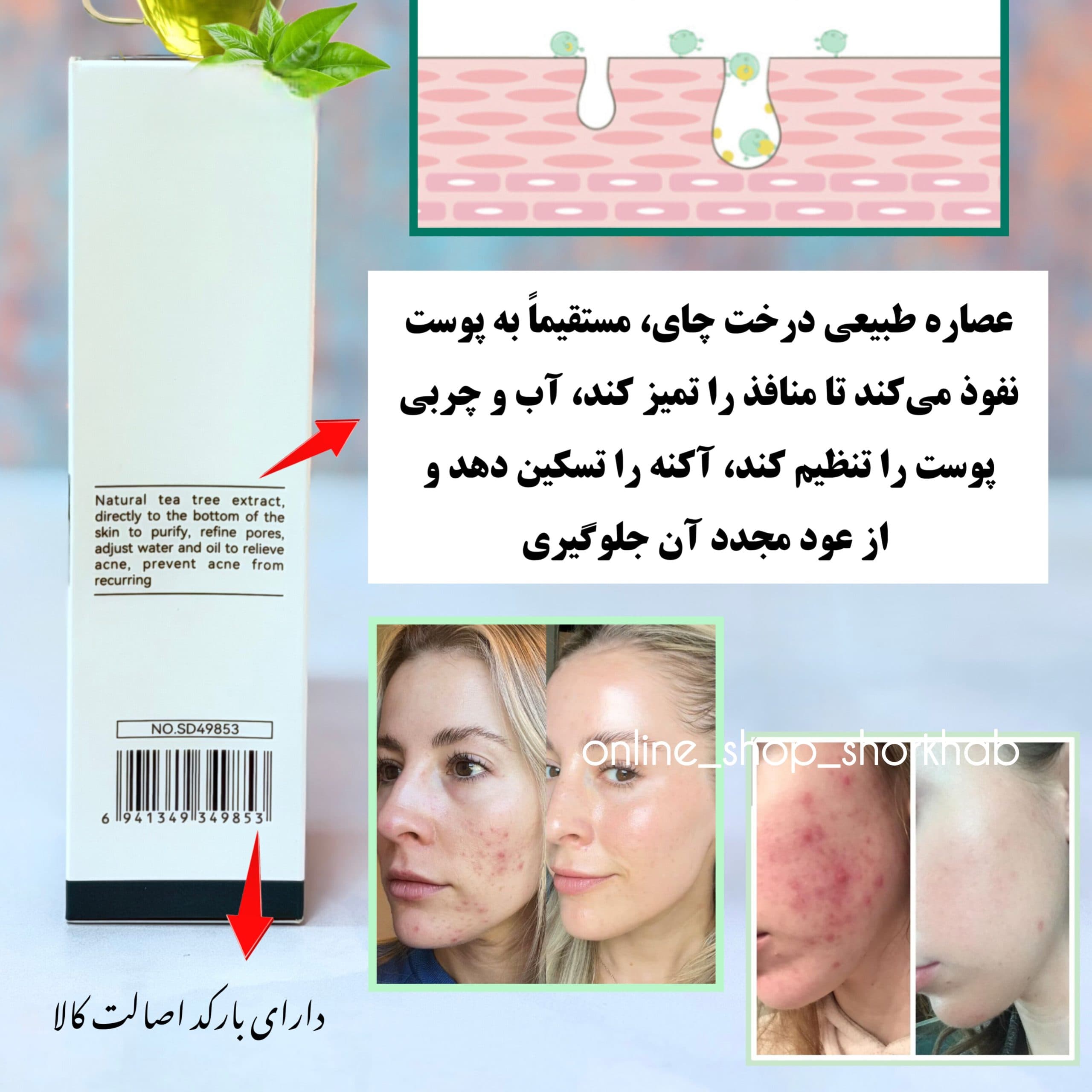 فوم شستشوی چای سبز ضد جوش — تصویر ۵