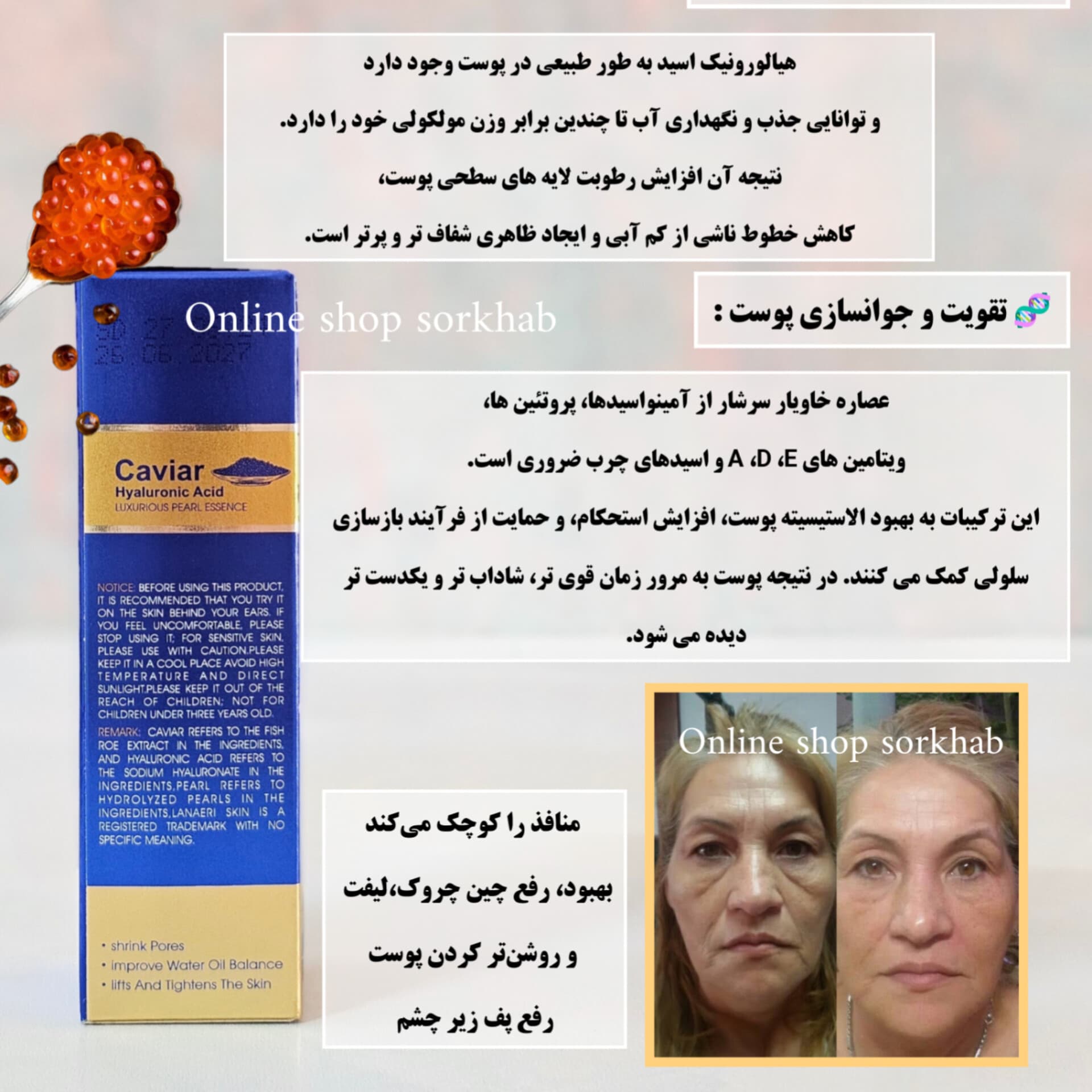 سرم جوانساز خاویار و هیالورونیک اسید سادور — تصویر ۵