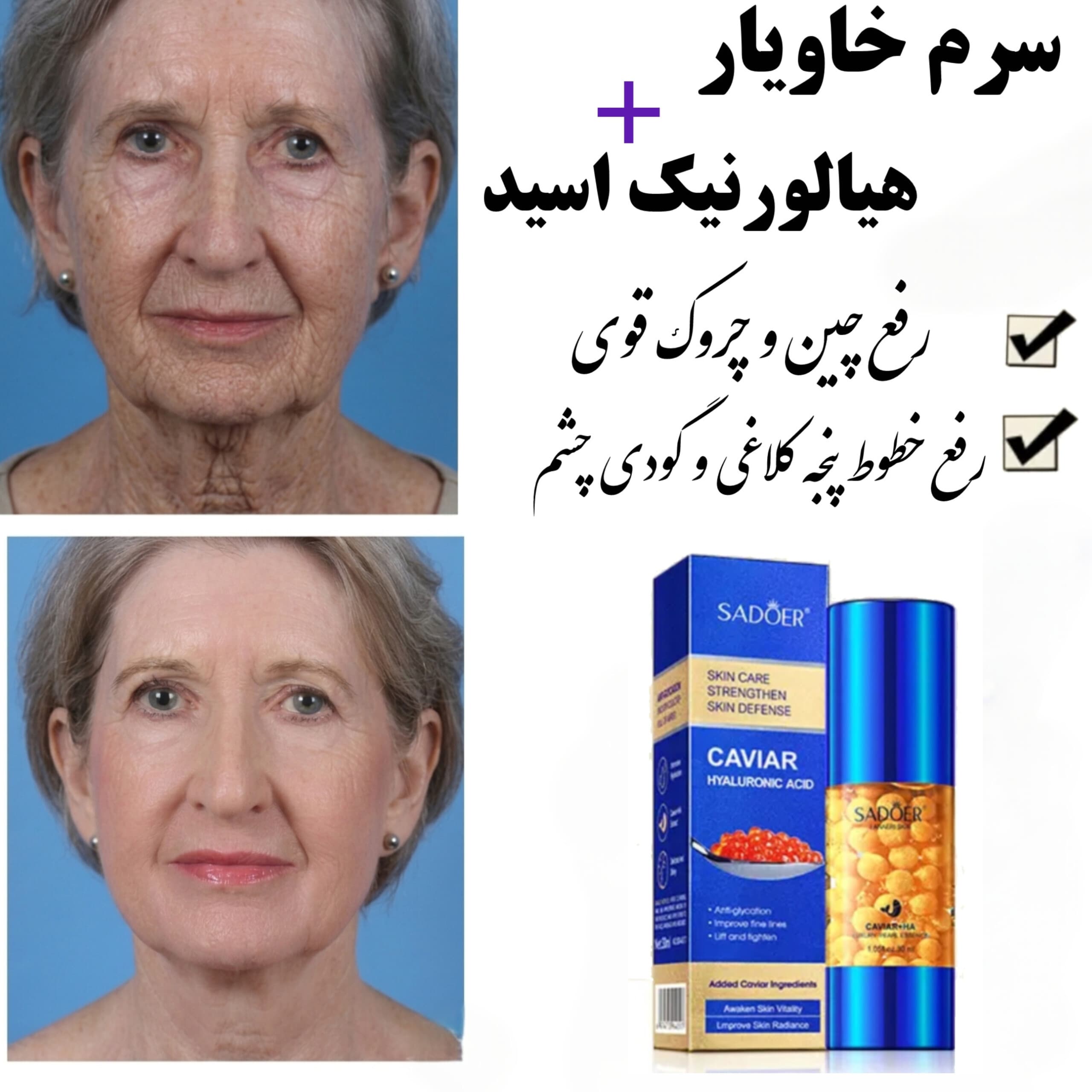 سرم جوانساز خاویار و هیالورونیک اسید سادور — تصویر ۱۰