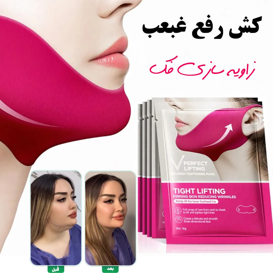 کش رفع غبغب