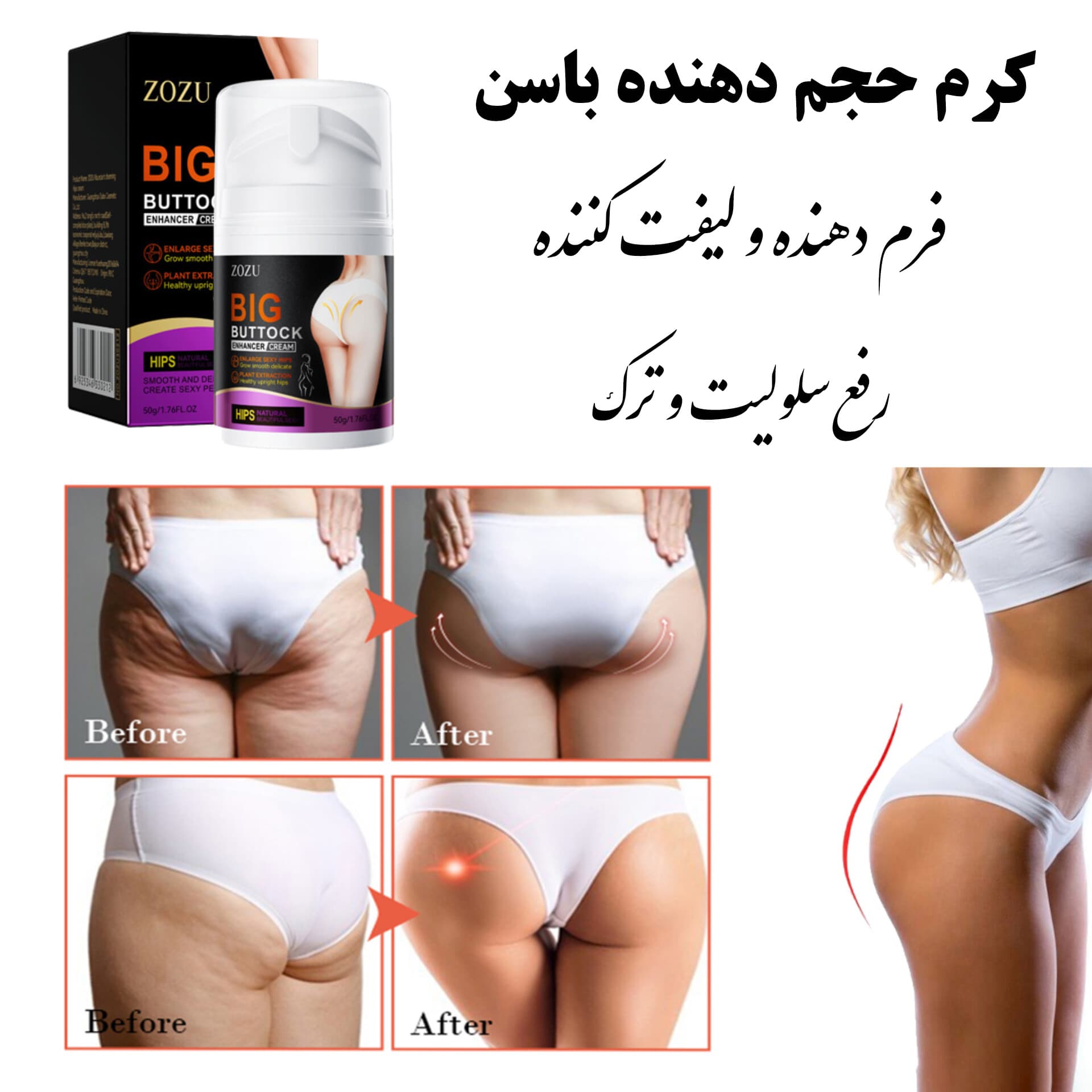 کرم حجم‌دهنده و لیفت باسن