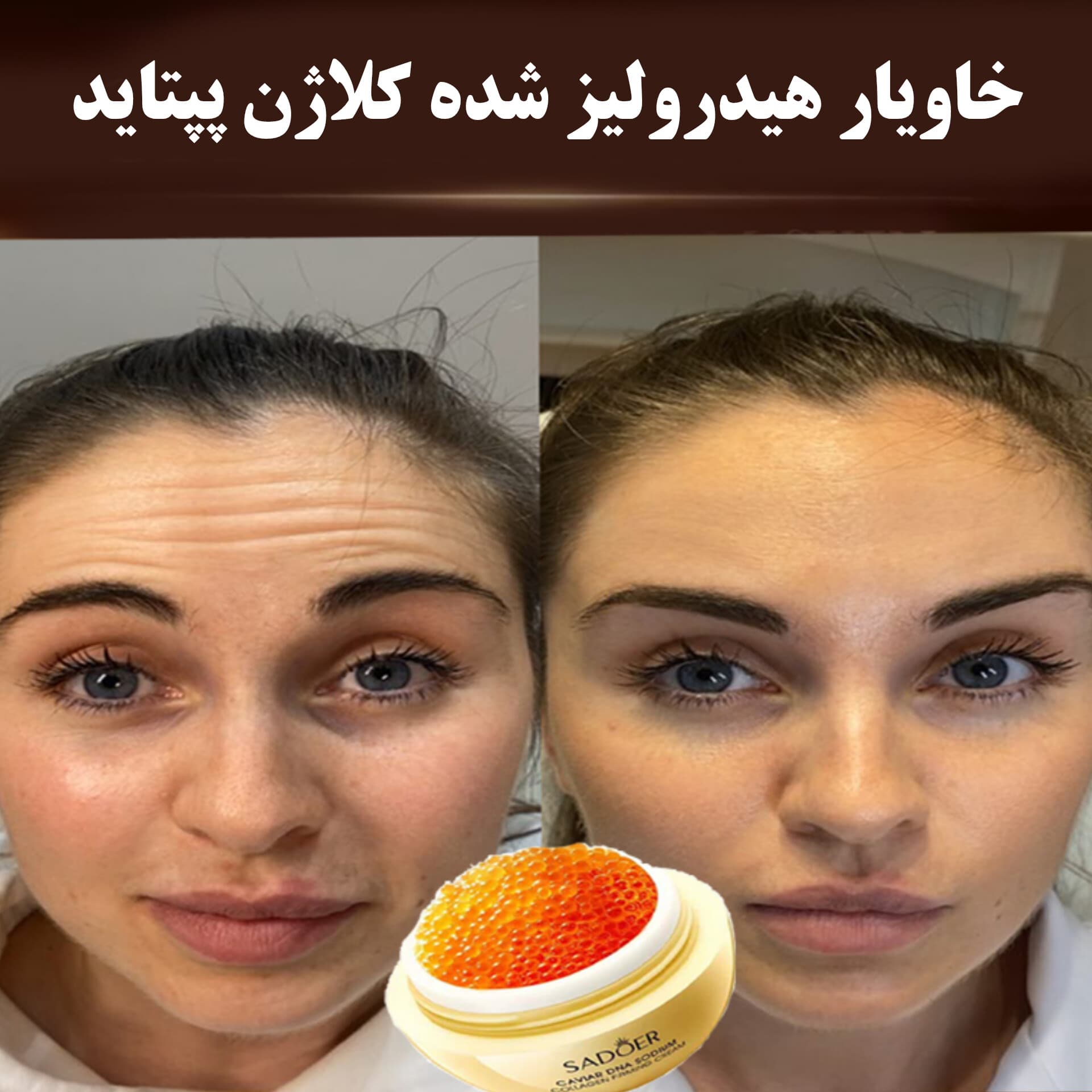 کلاژن هیدرولیز شده خاویار — تصویر ۵