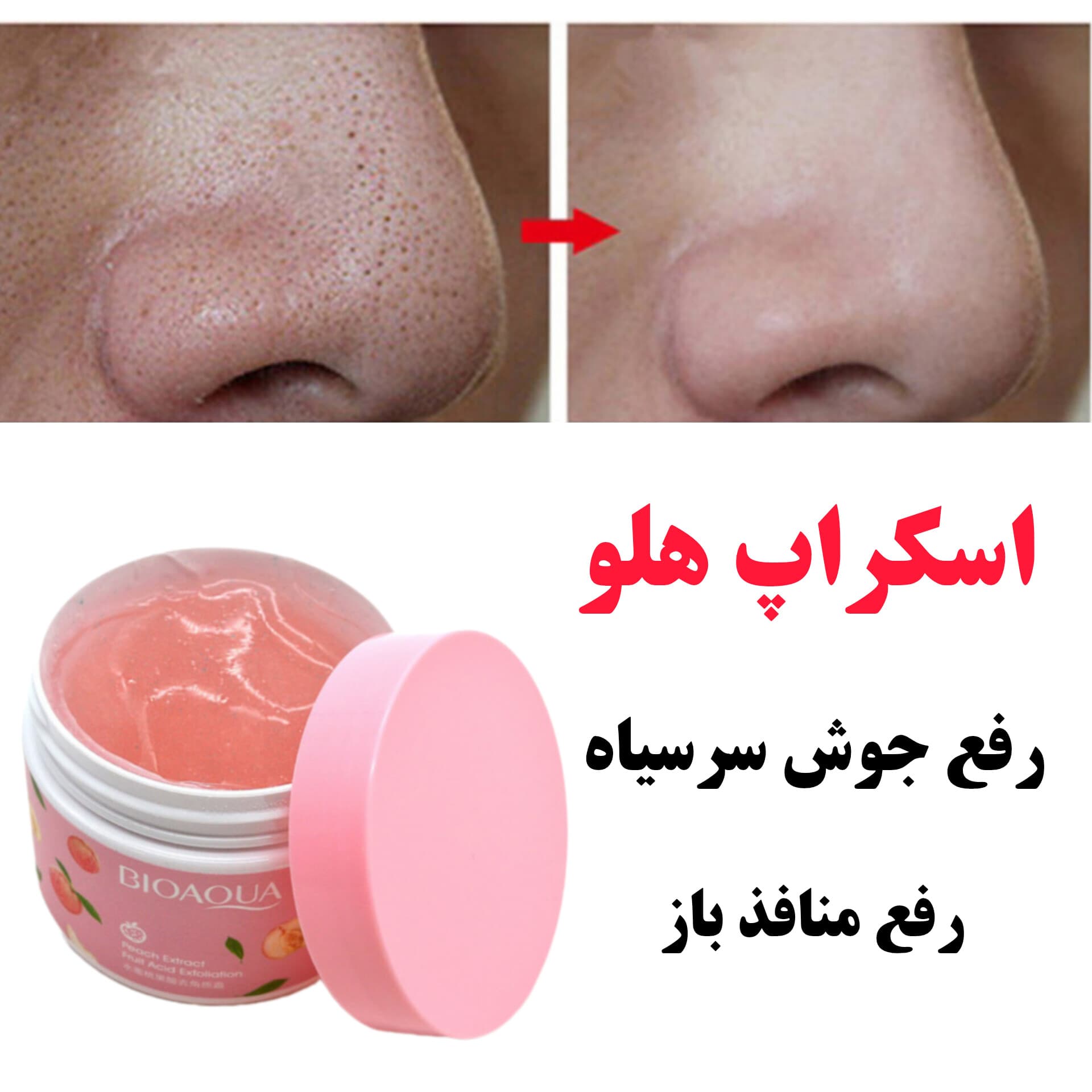 لایه بردار کره ای — تصویر ۵
