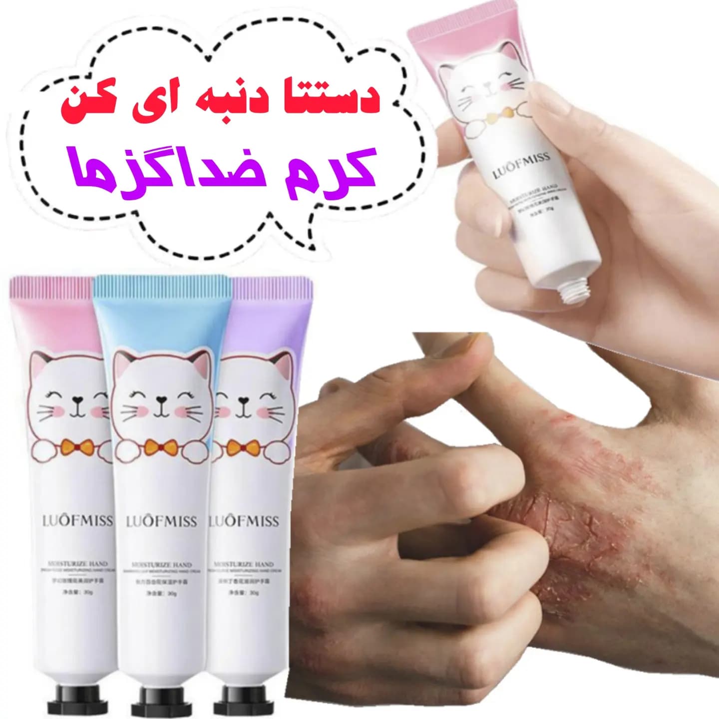 کرم دست لوفومیس