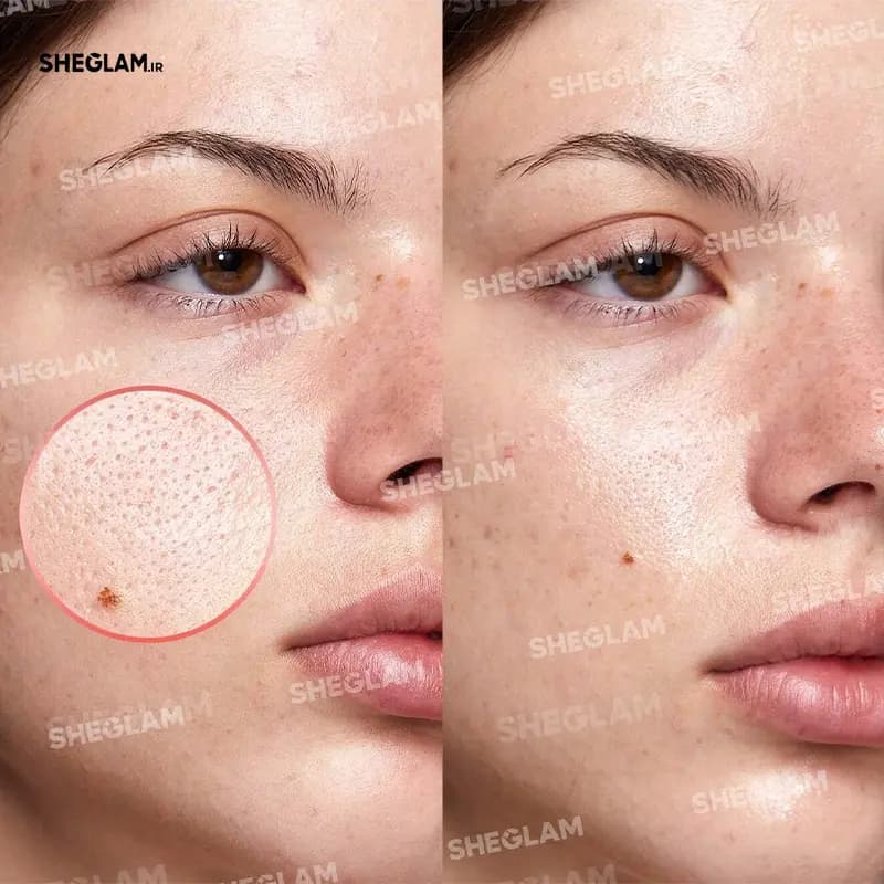 پرایمر نیاسینامید شیگلم — تصویر ۱۲