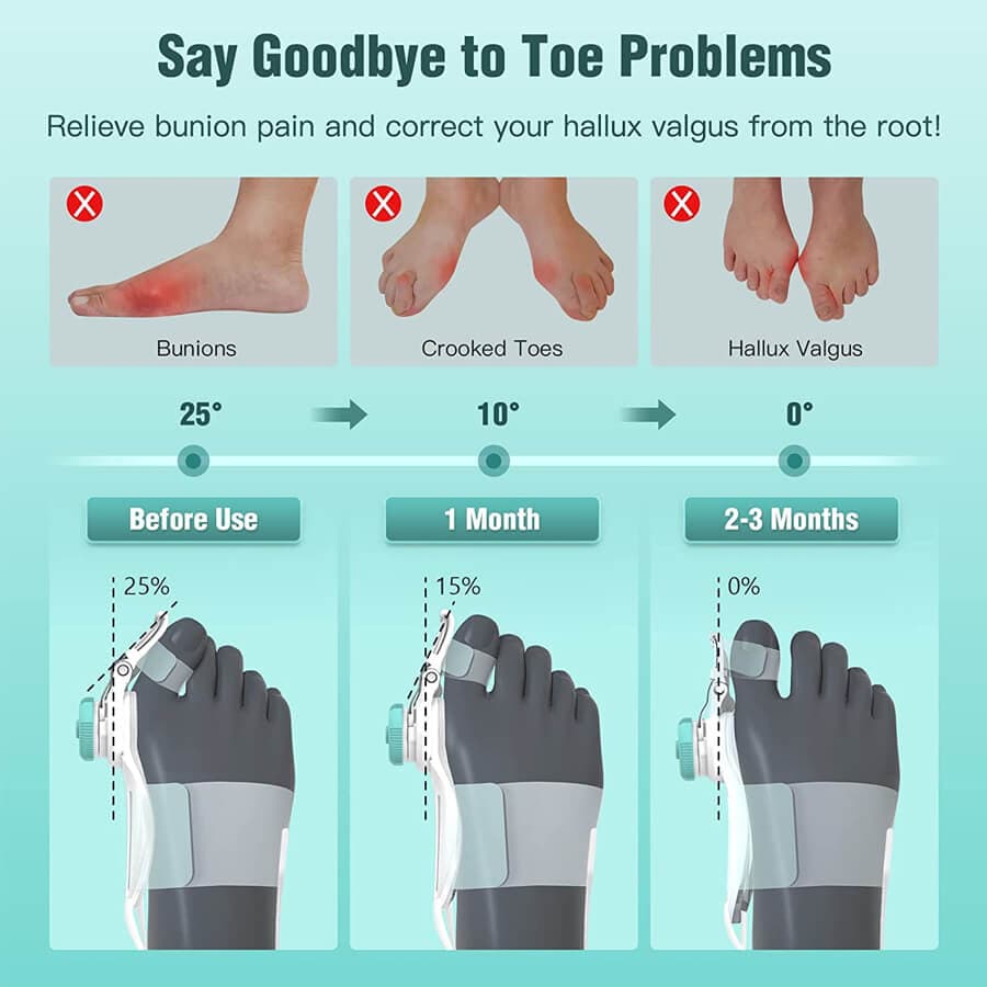 آتل انگشت شست پا تنیکور Tenicore MX3Q bunion corrector with anti-slip heel strap — تصویر ۴