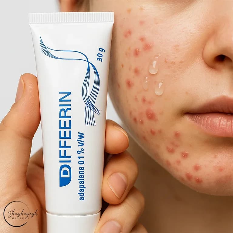 ژل ضدجوش و آنتی‌آکنه دیفرین گالدرما ۳۰ گرم Galderma Differin Gel — تصویر ۳