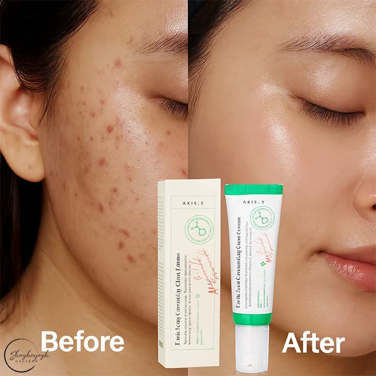 سرم ضدلک و درخشان‌کننده پوست اکسیس وای ۵۰ میل Axis-Y Dark Spot Correcting Glow Serum — تصویر ۳