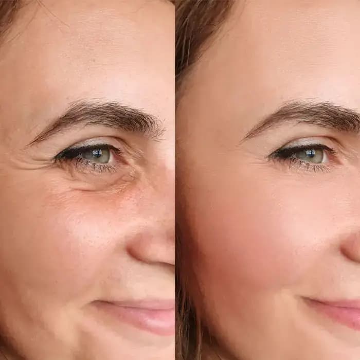 DERMO-RELAX کرم فوق تخصصی لیفتینگ دکتر بلتر 100 میل — تصویر ۳