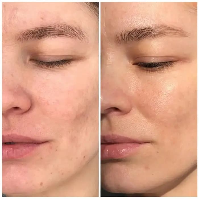 سرم کنترل کوپروز دکتر بلتر 30 میل — تصویر ۵