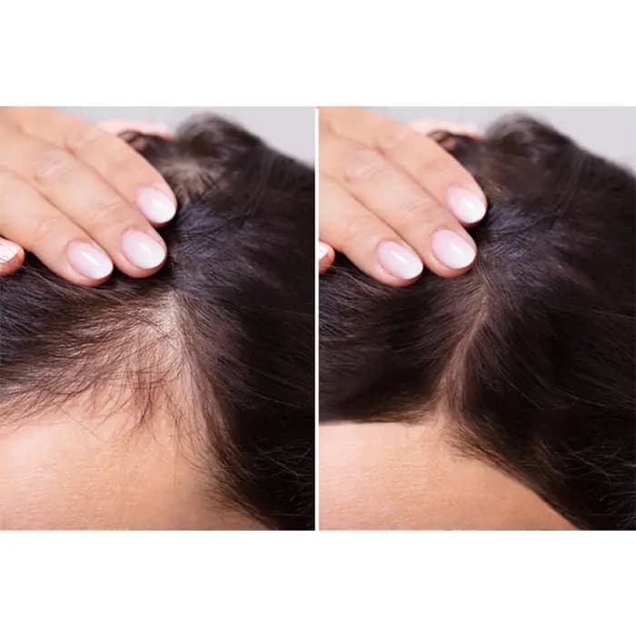 ويال كوكتل مو قابليت جذب با نيدلينگ تنورا 5*10 میل — تصویر ۵