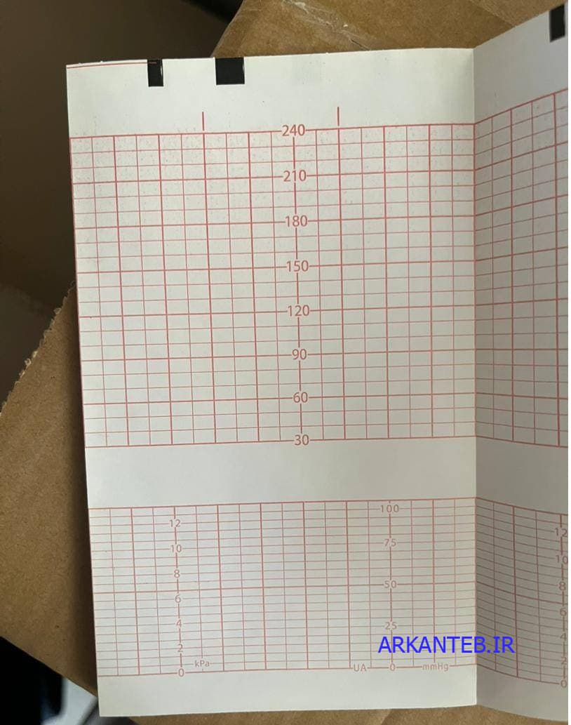 کاغذ فتال مانیتورینگ کامن نوع سوم Comen Star5000F کتابی سایز 152*90 میلی متر (ارسال از تهران – عمده فروشی) — تصویر ۵