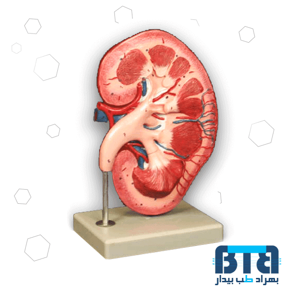مولاژ کلیه سه قسمتی