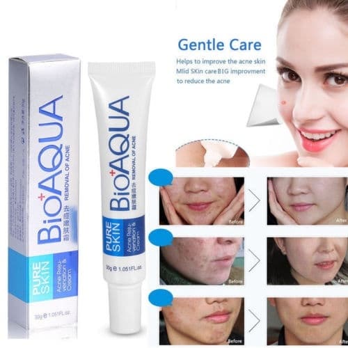 کرم ضدجوش و آکنه بیوآکوا BIOAQUA — تصویر ۵