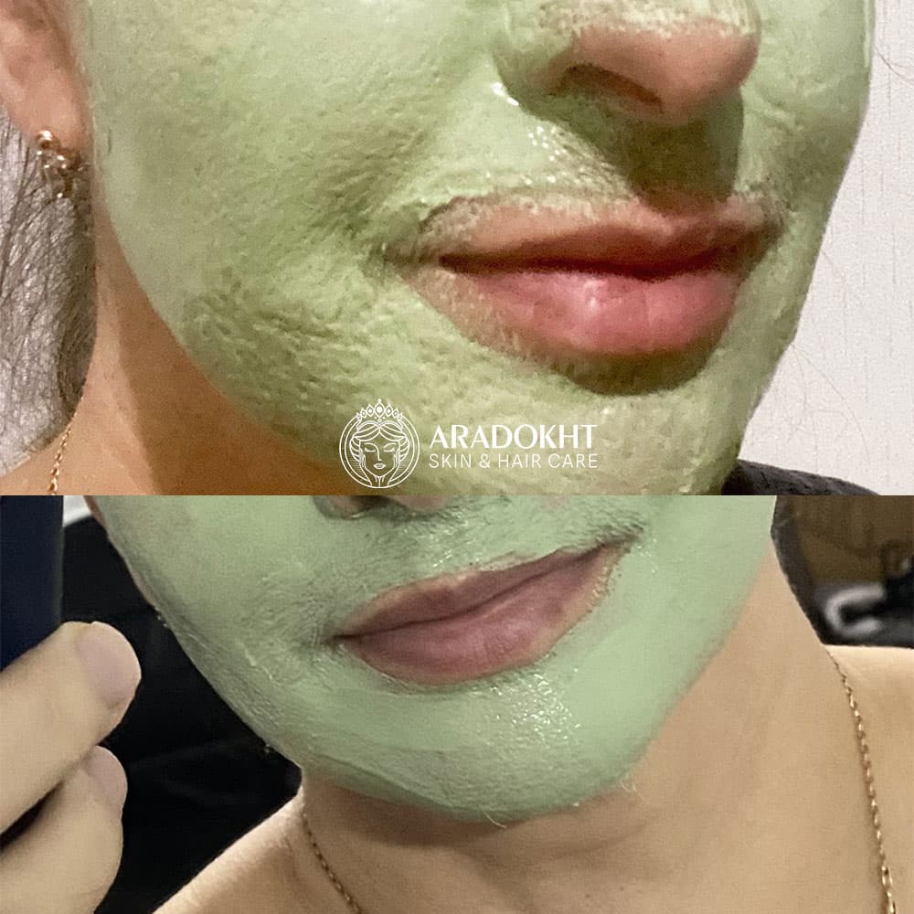 پک ماسک کنترل منافذ و تسکین دهنده خاک رس و چای سبز اسکین 1004 SKIN1004 Witch Pack Creamy Mud Pack with Green Tea — تصویر ۶