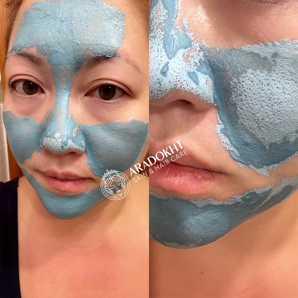 ماسک کنترل منافذ و ضدجوش سرسیاه مدی کیوب Medicube Zero Pore Blackhead Mud Mask — تصویر ۸