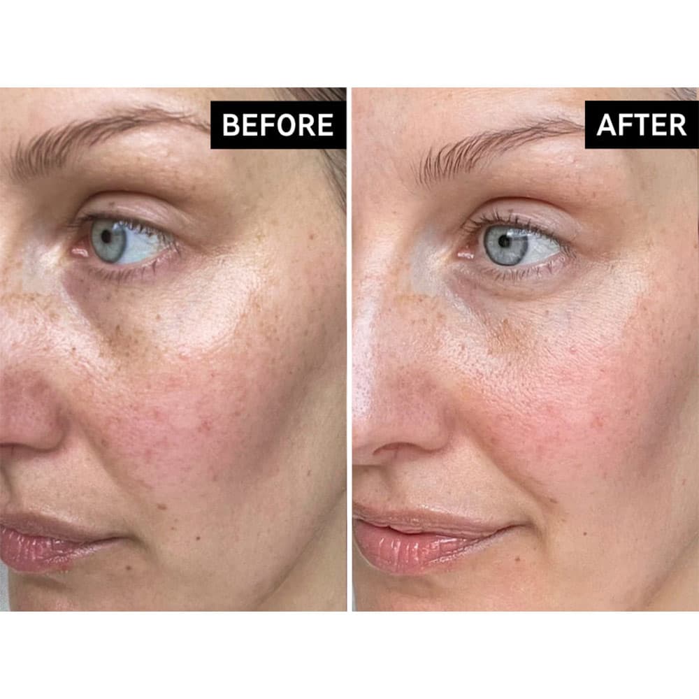 کرم مرطوب کننده و ترمیم کننده بایو اکتیو سراماید اینکی لیست The Inkey List Bio-Active Ceramide Repairing and Plumping Moisturizer — تصویر ۹