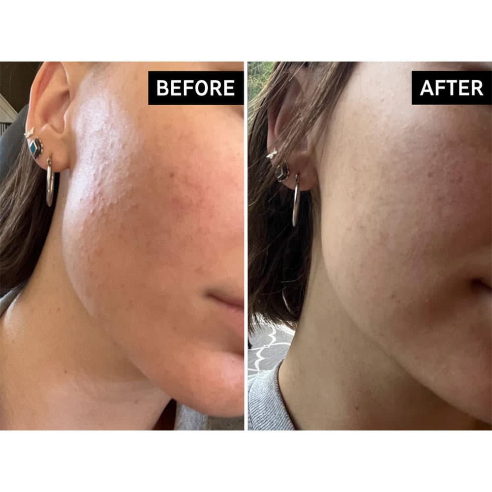 کرم مرطوب کننده و ترمیم کننده بایو اکتیو سراماید اینکی لیست The Inkey List Bio-Active Ceramide Repairing and Plumping Moisturizer — تصویر ۷