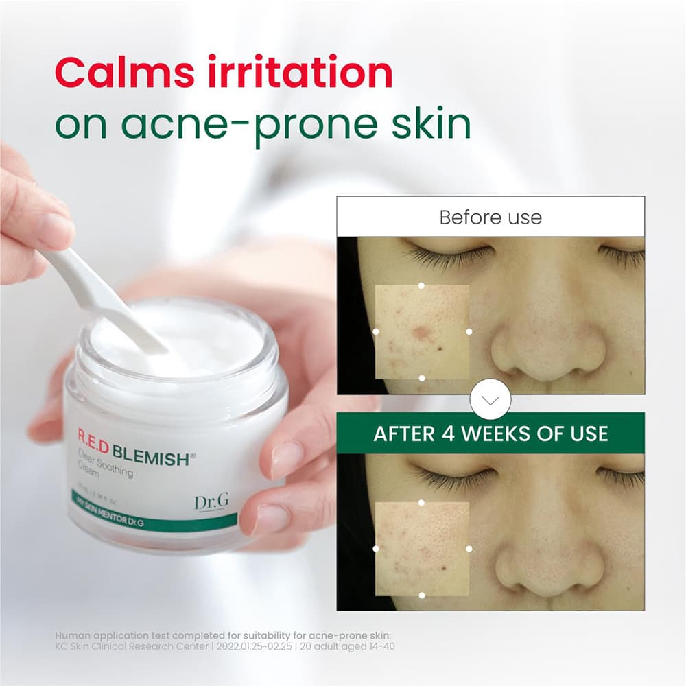 کرم آبرسان و تسکین دهنده رد بلمیش دکتر جی Dr.G Red Blemish Clear Soothing Cream — تصویر ۱۲