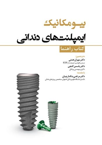 بیومکانیک ایمپلنت‌های دندانی — تصویر ۳